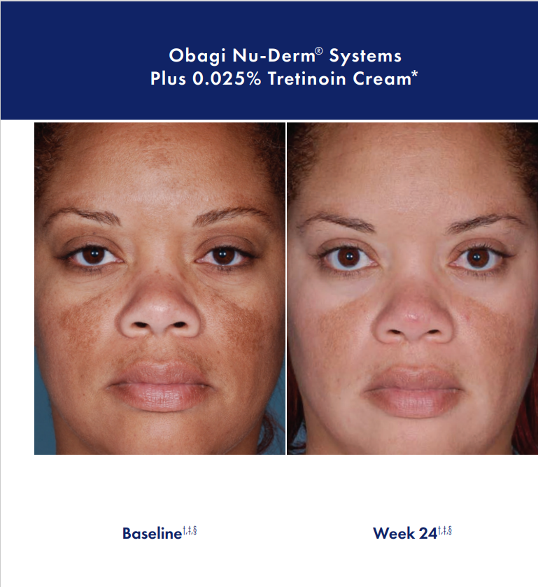 Face And Body Spa Flowood at Micheal Clark blog